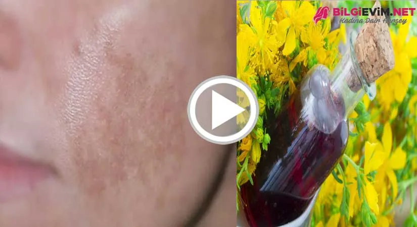 Kantaron Yağının Cilde Mucizevi Etkisi